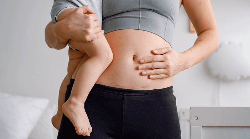 You must “bounce back” after childbirth.